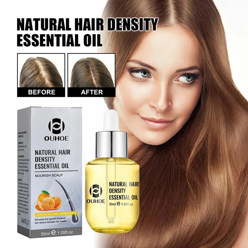 Wachstum 30 ml Ingwer für Männer Frauen Anti-Haarausfall Hydratisiert dichte Reparatur Wurzeln Kopfhautbehandlung Massage Essentials_voghion.com