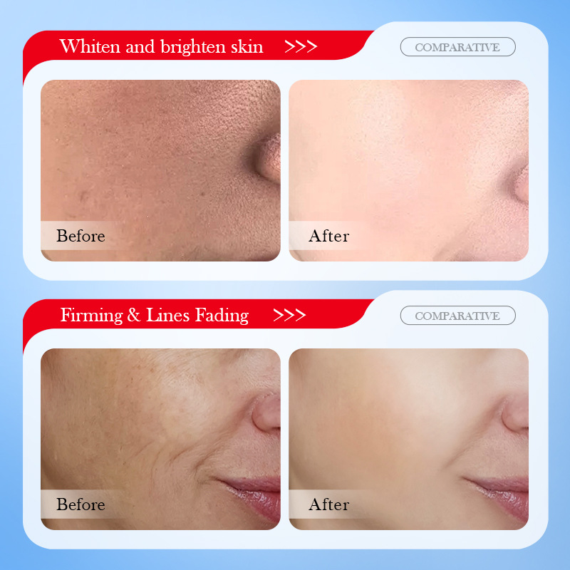 Alle Englisch SADOER kojic säure whitening sommersprossen entfernen feuchtigkeitsspendende und aufhellende gesichts maske_voghion.com