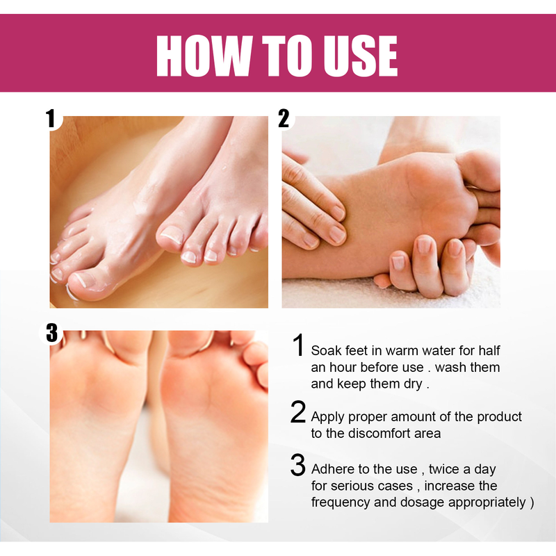 EELHOE Hand and Foot Moisturizing Repair Cream relieves itching, relieves itching, repairs dandruff, moisturizes and moisturizes the skin_voghion.com