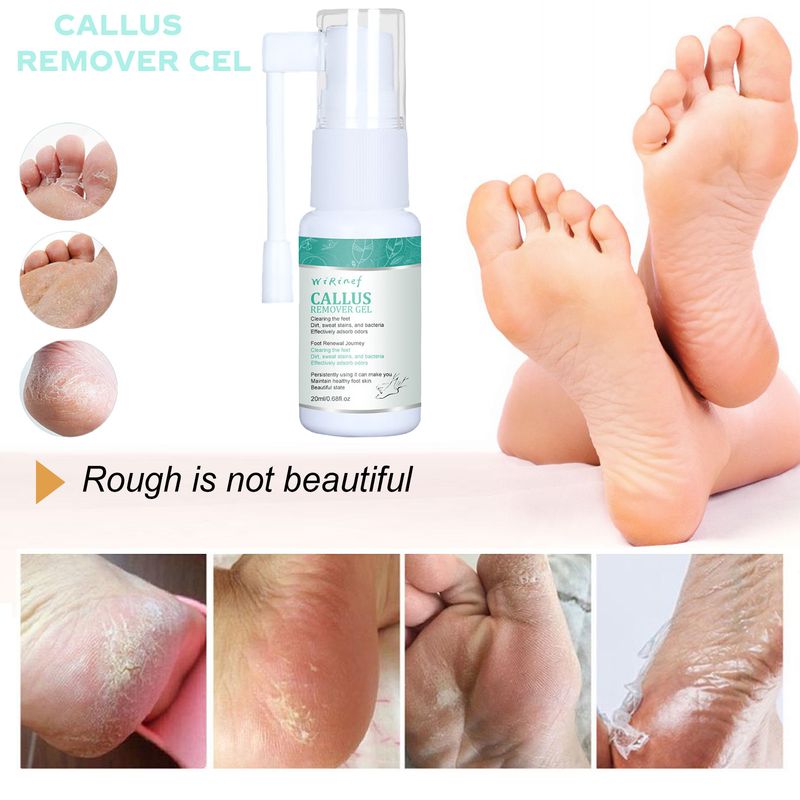 Spray Esfoliante Corpo, Mãos e Pés, Alivia a Pele Morta, Esfolia Hidrata e Limpa Profundamente_voghion.com