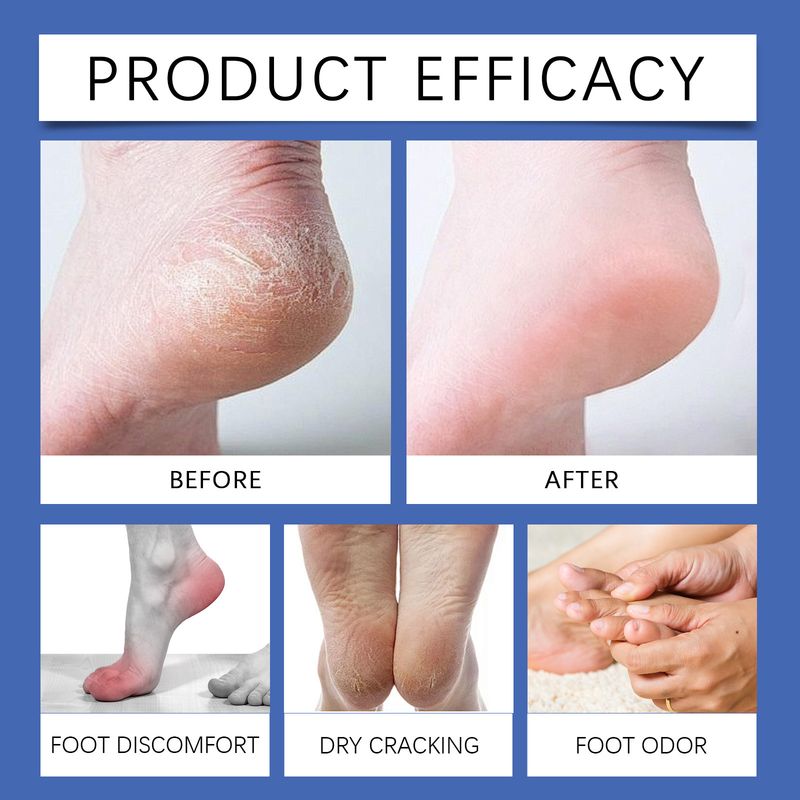 αλάτι Ximonth Cleaning Herbal Essence Ενυδατώνει την περιποίηση του δέρματος Πούδρα ποδιών μπάνιου_voghion.com