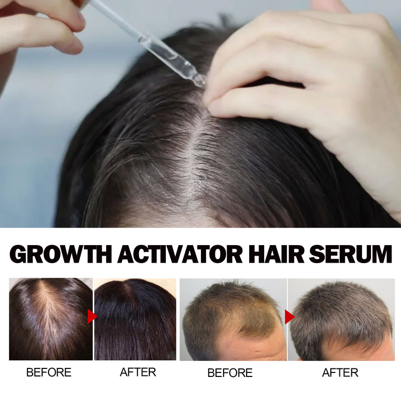 Esență OUHOE Dense Hair, păr puternic și ferm, masaj, hidratare rădăcini, reparare păr uscat, păros și deschis la culoare_voghion.com