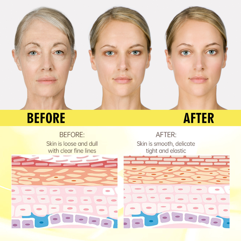 Hoygi näo pinguldav, niisutav, parandav, hämardav, vananev ja kortsudevastane essents_voghion.com