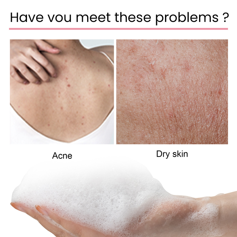 Mud Beautiful Carbon Back Soap Whitens the Body, Cleanses the Skin, Decreases Black Spots, Acne Marks, Exfoliates,_voghion.com