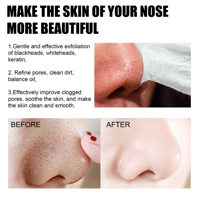 Masque nasal déchirable amovible Nettoie en douceur les pores Absorbe les points noirs et l'acné avec 60 feuilles de papier 2024_voghion.com