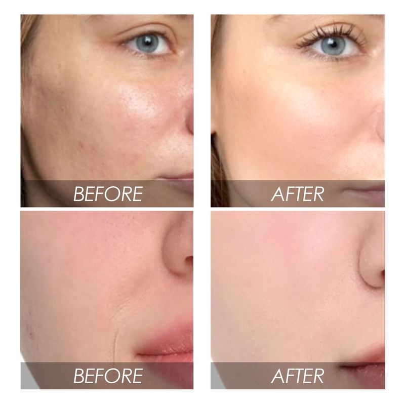 EELHOE Watermelon Facial Essence Hydrates, Moisturizes And Nourishes The Facial Skin, Making It Tender And Delicate For Daily Care_voghion.com