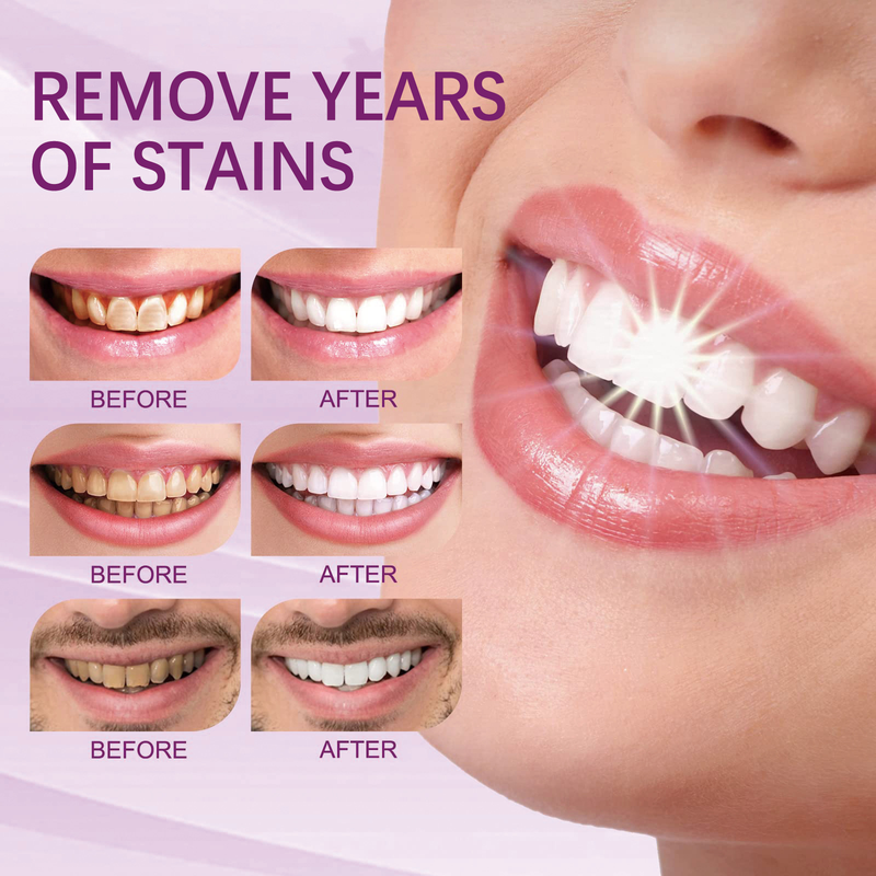 EELHOE V34 Teeth Whitening Toothpaste Cleans Teeth Stains, Cares for Gums, Whitens Teeth, Oral Care Toothpaste_voghion.com