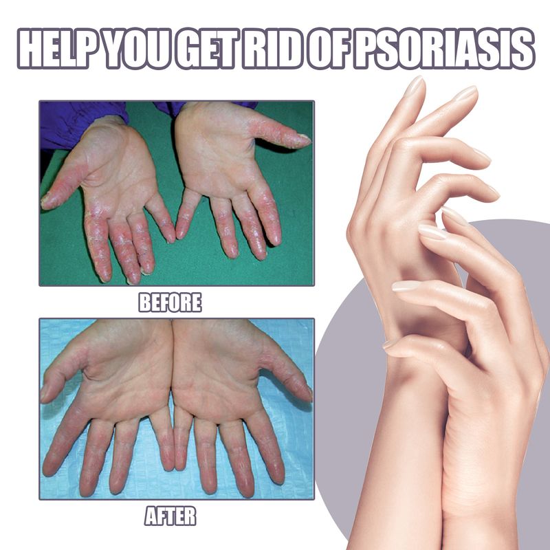2025 Hand Foot Relieves Dry Rough Skin, Nourishes, And Moisturizes Skin Care Spray_voghion.com