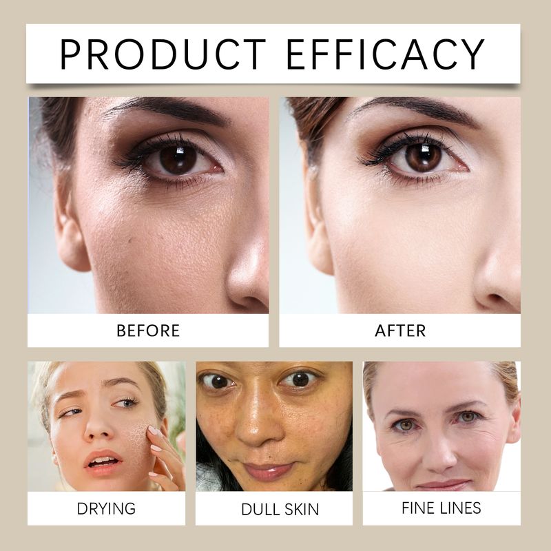 Hoygi Tallow Moisturizer Nourishes And Moisturizes Dry Skin With A Soft Smoothing Cream_voghion.com