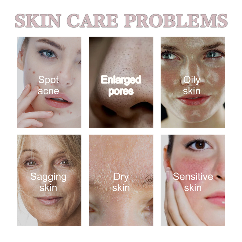 West&Month Peel-off Feuchtigkeitsspendend, aufhellend, Mitesser entfernend, Poren straffend, Pickel verkleinern Gesichtsmaske auftragen_voghion.com
