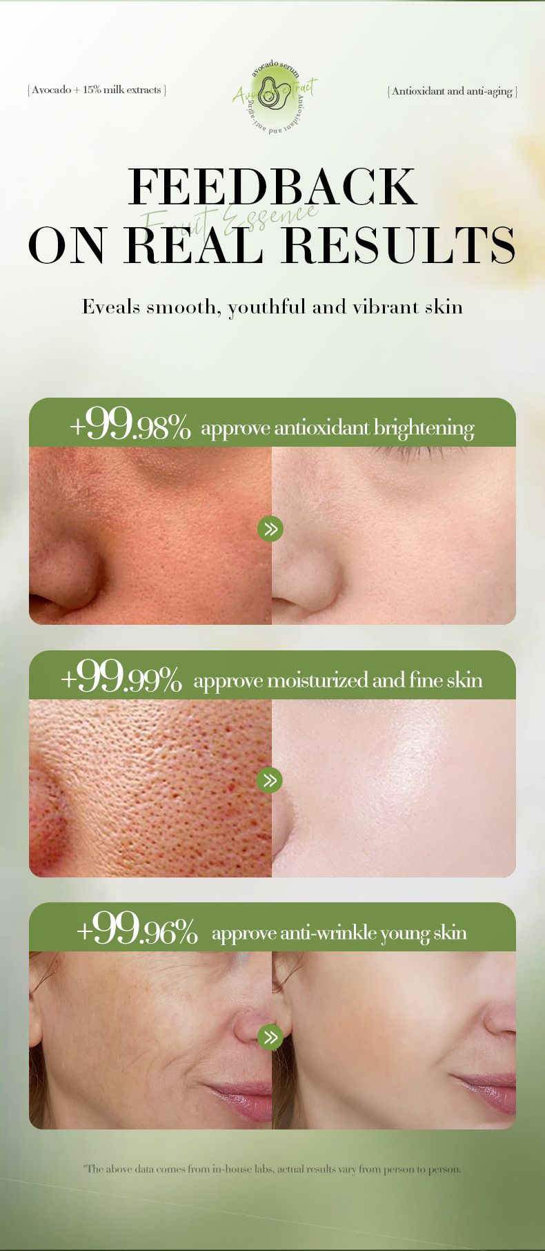 SADOER Strawberry Fruit Milk Serum 30ml Moisturizing And Smooth Skin Tender Brightening Moisturizing And Hydrating Serum_voghion.com