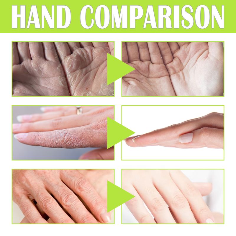 West&Month Green Tea Moist Repair Hand Mask, Moisturizing Tender Skin Removing Dead Skin Preventing Dry Cracking And Firming Care Hand Mask_voghion.com