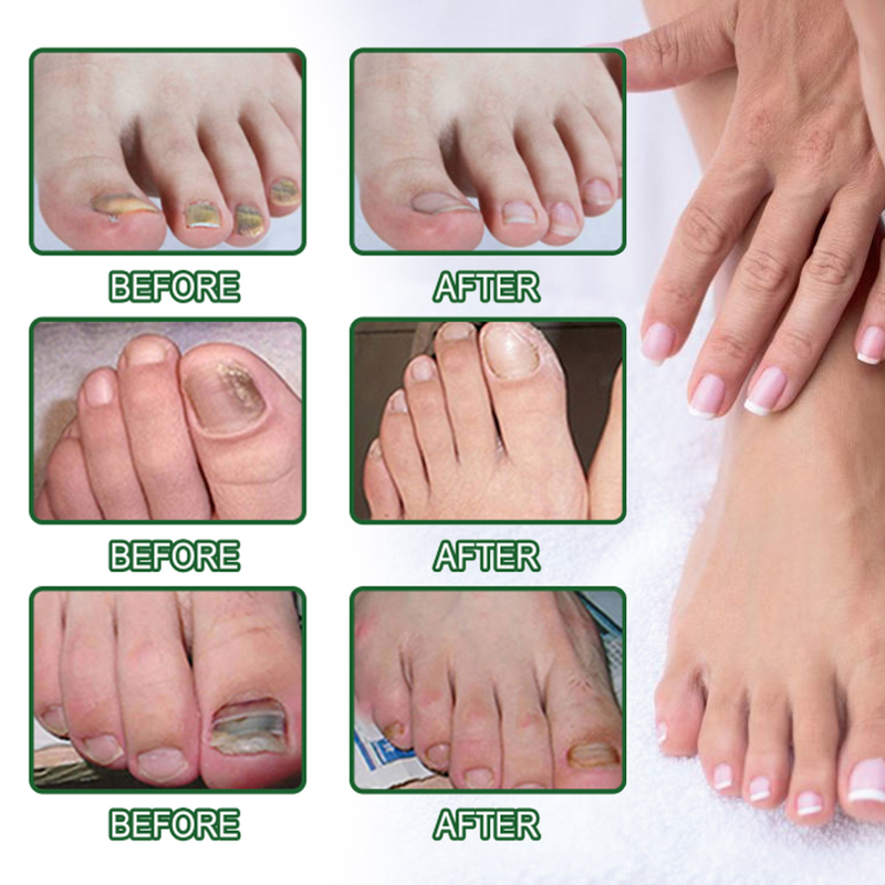 EELHOE Nutrition Grey Bright Gel Dikke verzachtende nagelreparatievloeistof_voghion.com