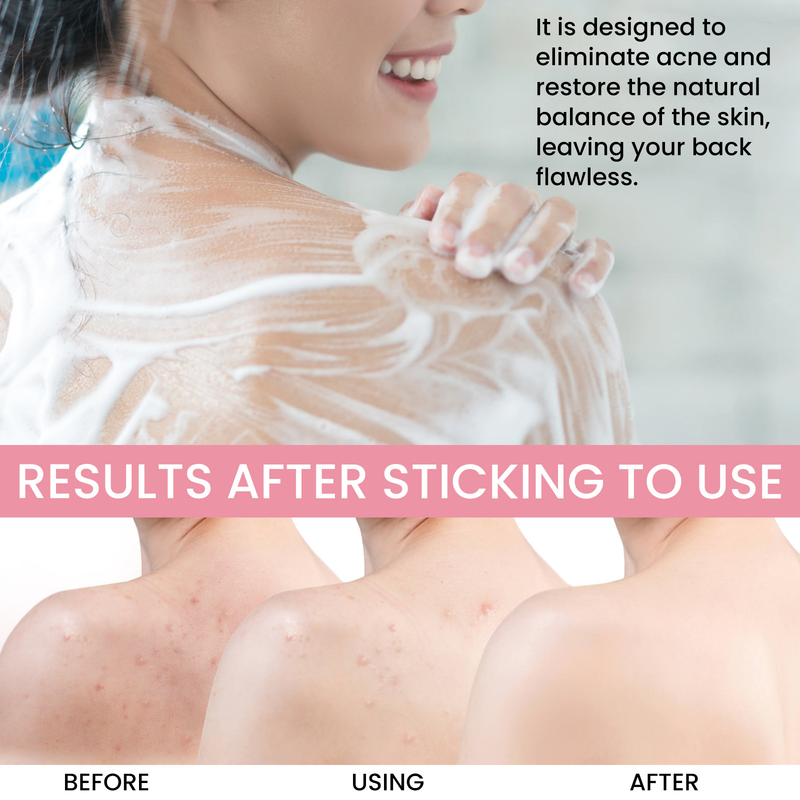 Mud Beautiful Carbon Back Soap Whitens the Body, Cleanses the Skin, Decreases Black Spots, Acne Marks, Exfoliates,_voghion.com