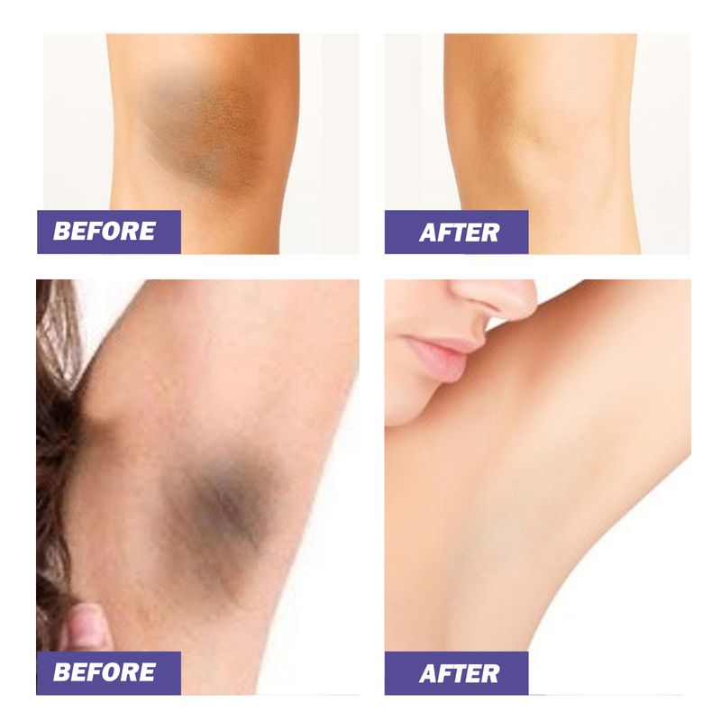 EELHOE Whitening Cream For Armpit Joints Reduces Melanin, Moisturizes And Smooths Skin, Refreshing And Non-Greasy_voghion.com