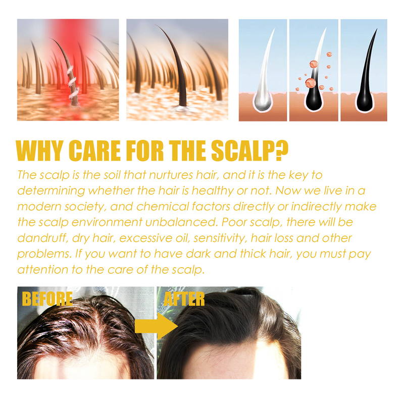 Confezione di shampoo per capelli neri South Moon L'essenza di zenzero idrata i capelli Cura detergente naturale per capelli neri_voghion.com