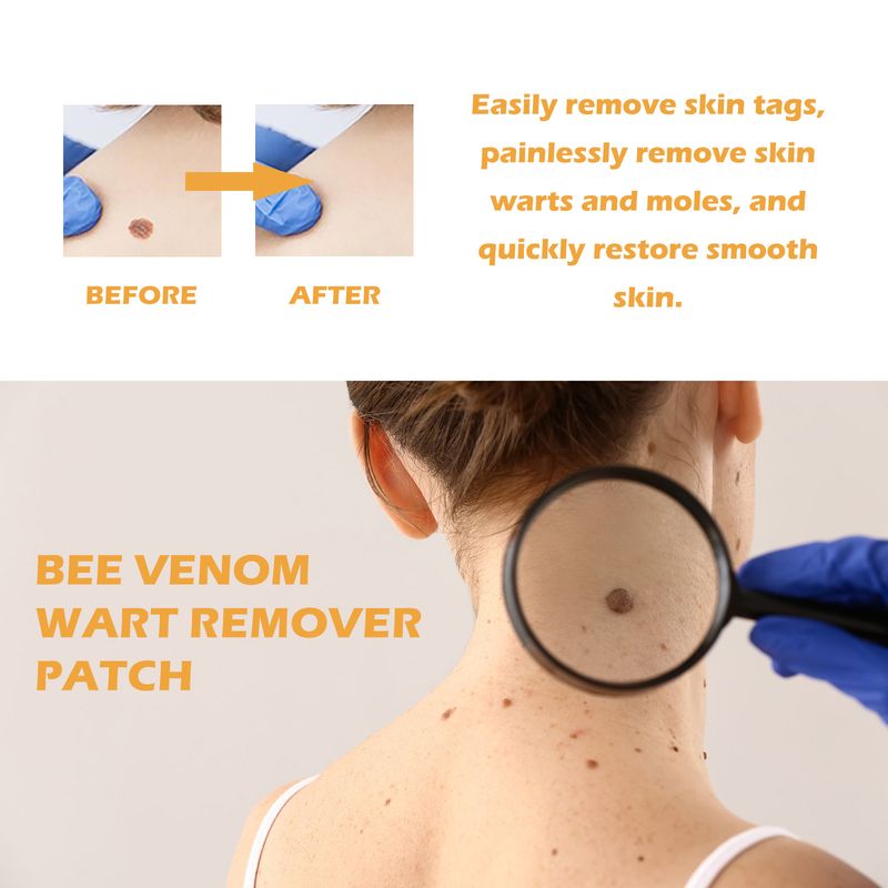 Le patch anti-verrues au venin d'abeille Ximonth nettoie en douceur la peau, éclaircit les granules, les grains de beauté, les verrues et lisse la peau_voghion.com