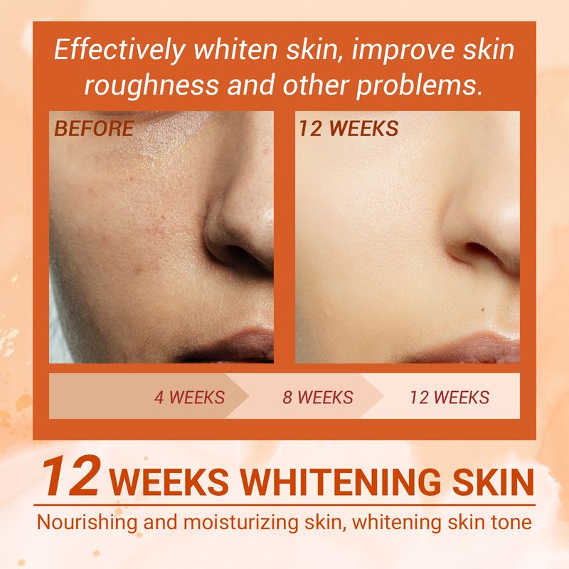 EELHOE Vitamin c Moisturizing Rejuvenating&Whitening spray Moisturizing&Moisturizing Skin to Lighten Acne Spots_voghion.com