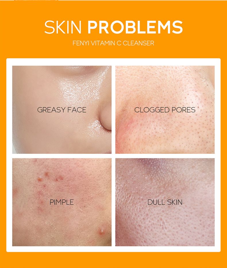 Fenyi Fenyi Detergente Viso alla Vitamina C 50g Deterge i Pori Detergente Idratante_voghion.com