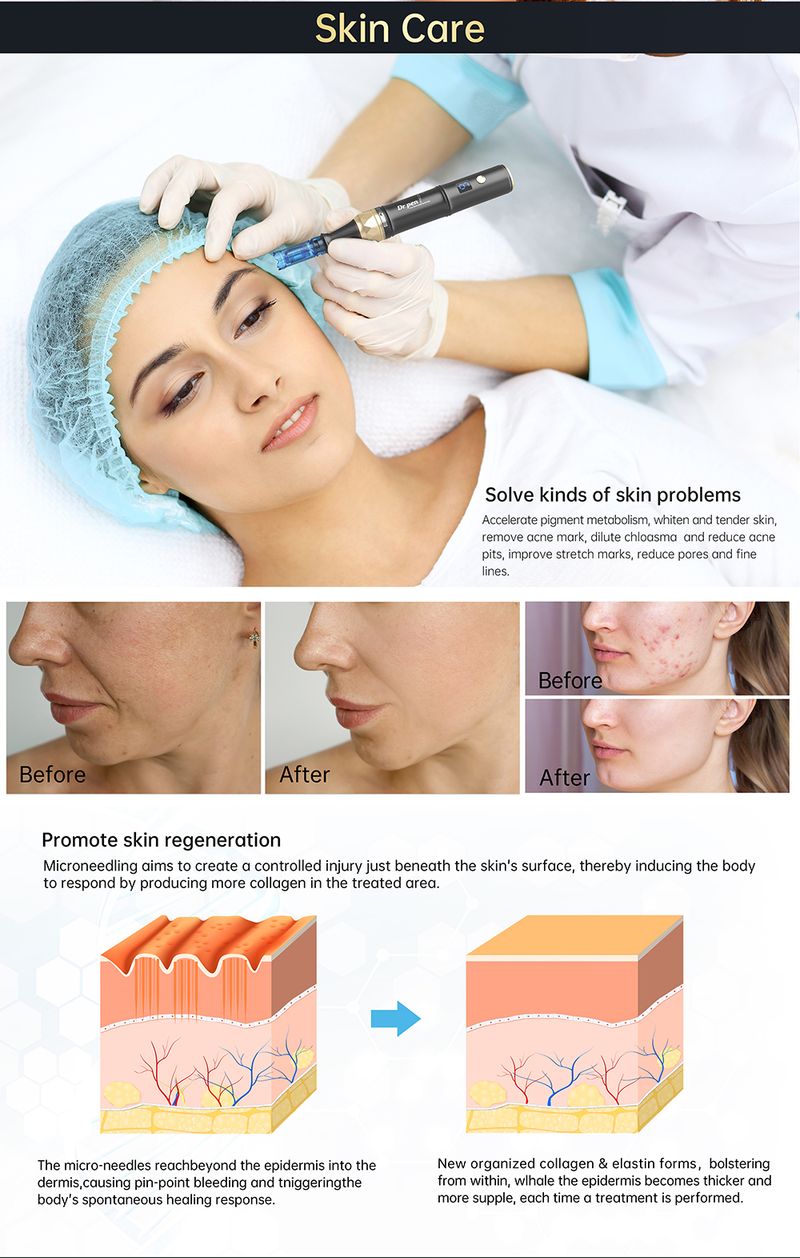 Authentischer Dr. Pen Ultima A8S Microneedling-Stift mit 12 Nadeln, kabelloser Derma-Pen mit Anti-Rückfluss-Effekt, Schönheitsmaschine für die Hautpflege_voghion.com