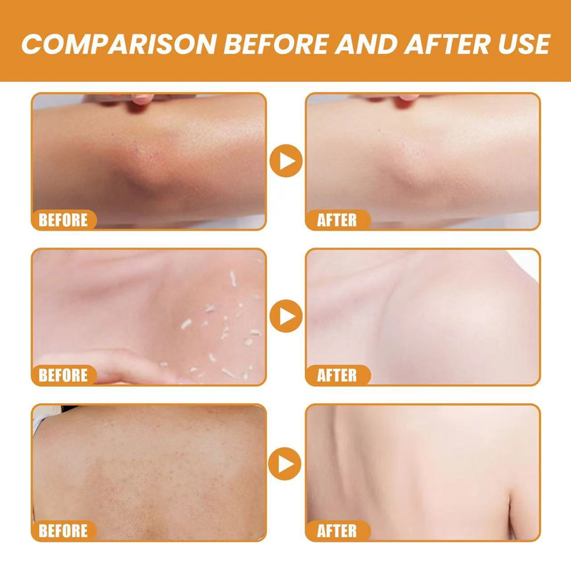 Orange renser porer, lysner, bleger, opvarmer hudorme og eksfolierer gel_voghion.com