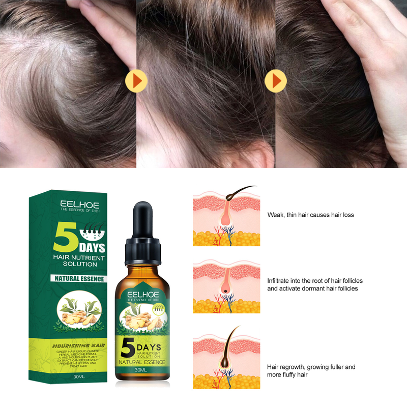 Ginger Dense EELHOE Haargroei Anti-verlies etherische olie verzorgingsvloeistof_voghion.com