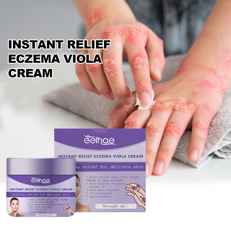 EELHOE Skin Repair Cream käte jalasambla parandamiseks, sügeluse ja punetuse leevendamiseks ning niisutav nahahoolduskreem_voghion.com