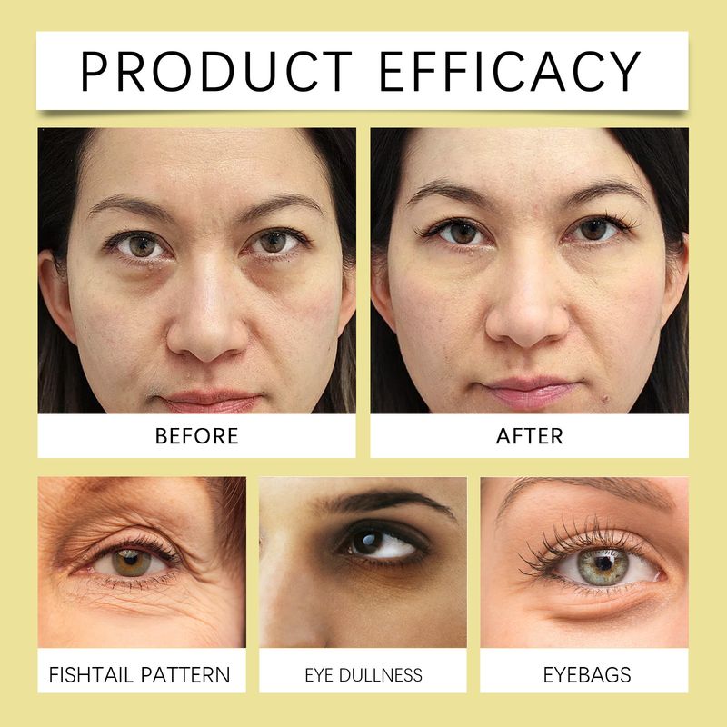 Το τζελ περιποίησης ματιών Hoygi θρέφει απαλά και βελτιώνει την επιδερμίδα γύρω από τα μάτια_voghion.com