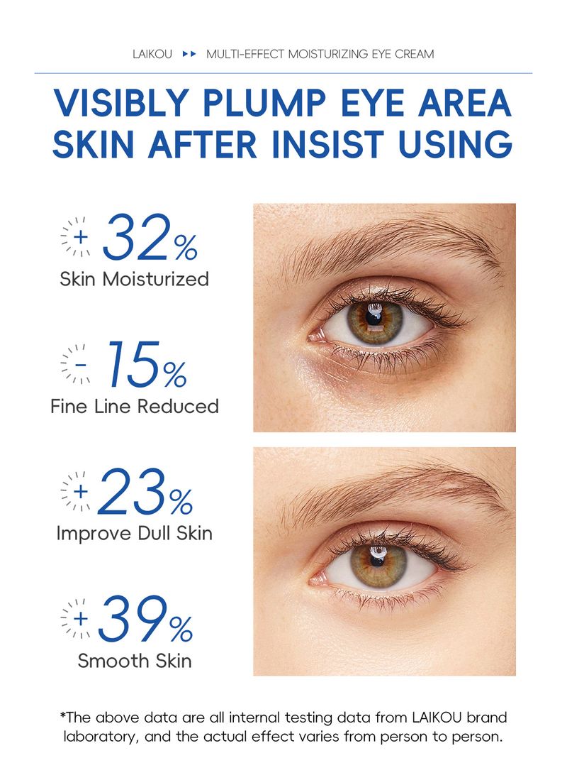 Κρέμες Ενυδατική Κρέμα Ματιών με Ρόλερ 20g Ενυδατική Φροντίδα Ματιών Προϊόντα Περιποίησης Δέρματος Ματιών_voghion.com