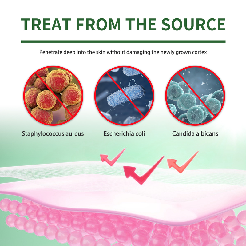 Máscara para os pés Moon South para reparação de unhas Máscara para os pés para reparação de unhas Unhas grisalhas Unhas brilhantes Pés secos e rachados Removendo pele morta_voghion.com