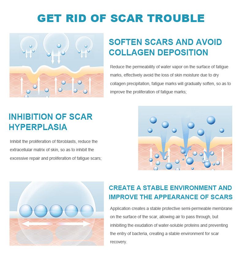 2025 Popular Cream Desalination Scar Cream Ointment Cold Compress Gel Smooth Repair_voghion.com