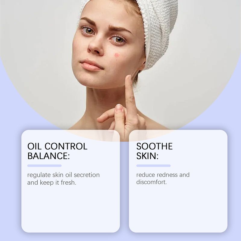 OUHOE Acne Essence Hydrates, Controls Oil, Refines Pores, Lighens Acnes, Improves Red Skin_voghion.com