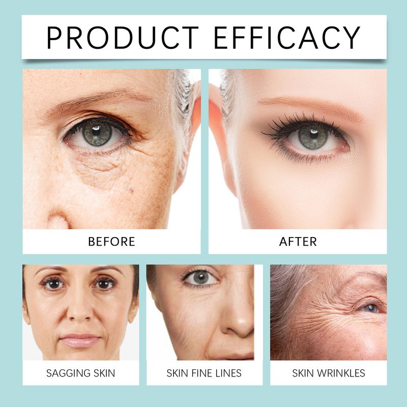Crema viso alla bava di lumaca WIYUN Mucus Protein idrata, nutre a lungo, idrata e illumina la pelle_voghion.com