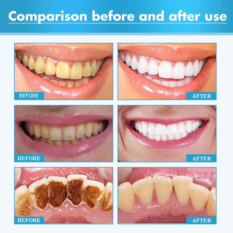 Tandpasta West&Month Kruidenmousse voor het bleken van tanden Reiniging Geur en vlek in de mond Tanden bleken schuim_voghion.com