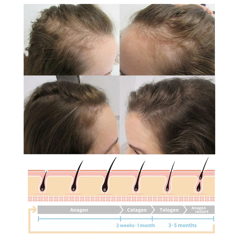 essence EELHOE Ginger Nourishing Conditioner Toughness Repairing Liquid Hair Root Care spray_voghion.com