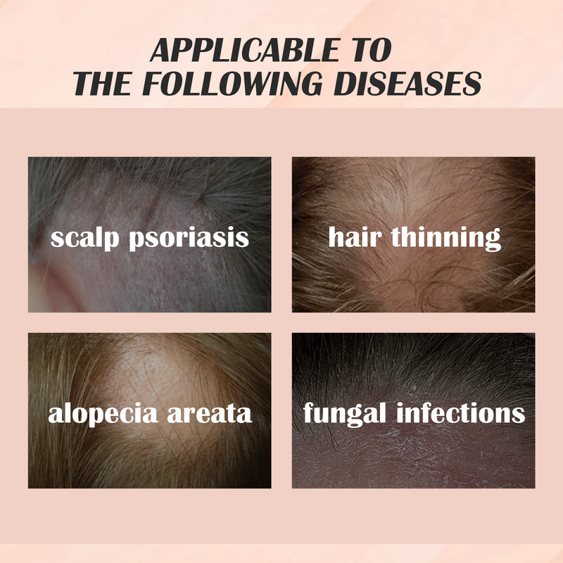 EELHOE cowhide moss hair care essence cleans scalp, dispels dandruff, relieves itching, refreshes, controls oil and_voghion.com