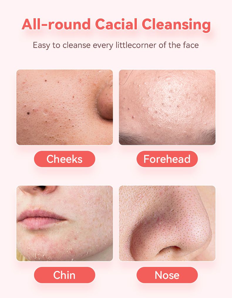 Espátula ultrasónica para rostro, exfoliante, raspador y eliminador de puntos negros, limpiador de poros, limpieza facial profunda, nuevo y popular._voghion.com