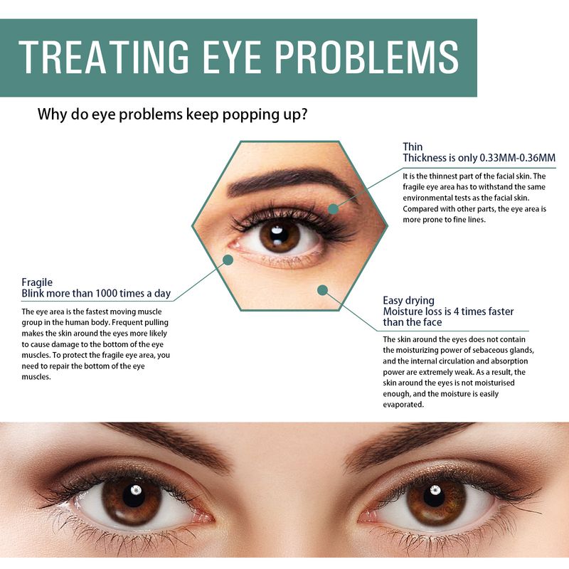 Nicotinamide oogcrème Donkere kringen Verwijdert wallen Hyaluronzuur Hydraterend serum Tegen wallen Oogverzorgingsgel_voghion.com