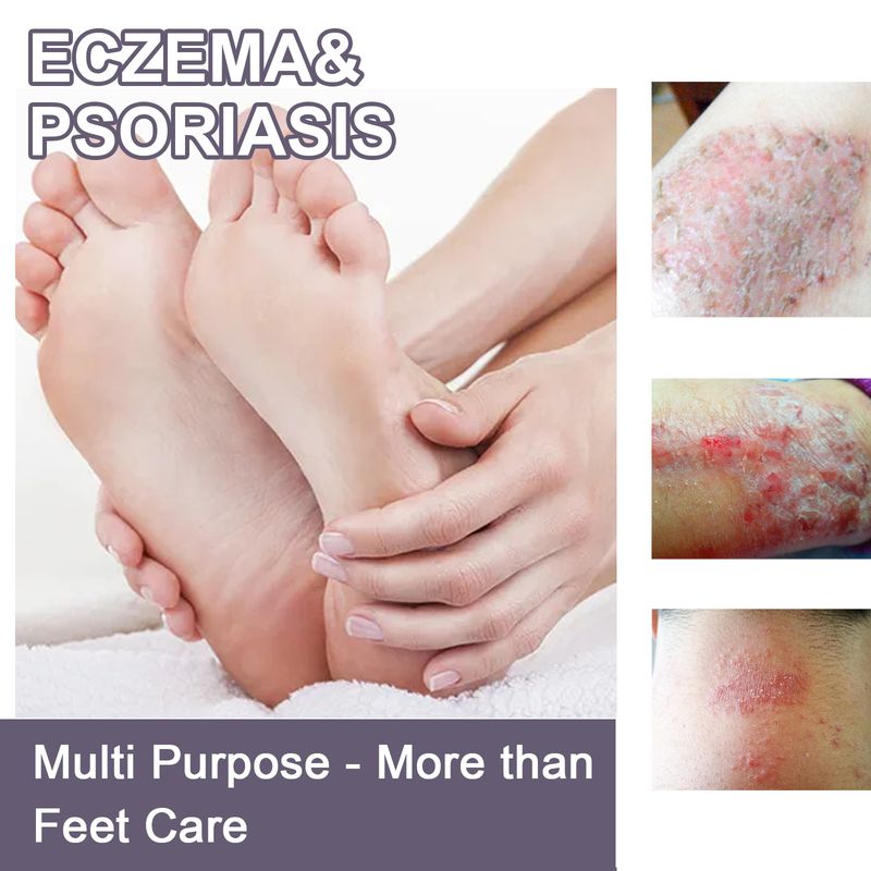 2025 Hand Foot Relieves Dry Rough Skin, Nourishes, And Moisturizes Skin Care Spray_voghion.com
