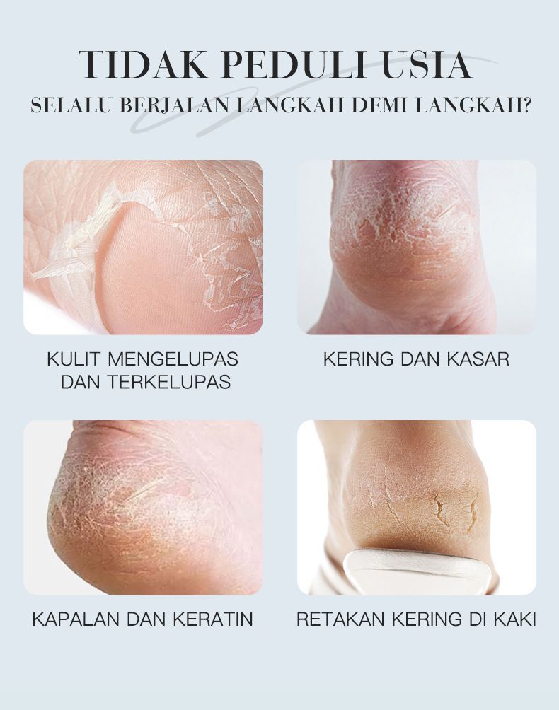 KORMESIC Foot Cream Hydrating And Moisturizing Foot Cream 60g_voghion.com