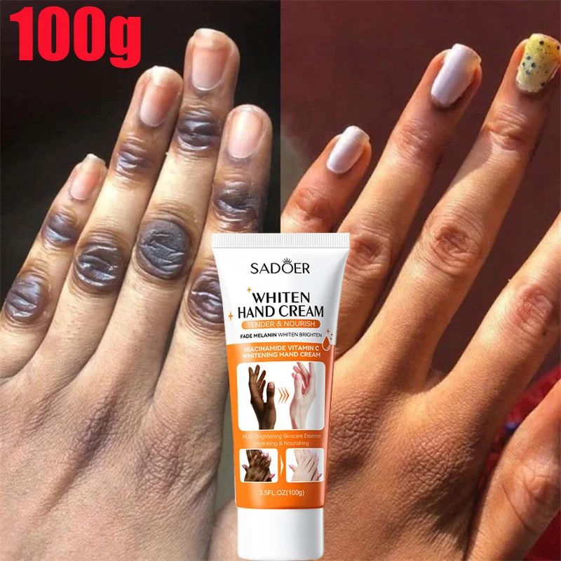 Aufhellende Handcreme für dunkle Fingerknöchel, Pigmentkorrektur, Anti-Riss-Serum, schwarze Haut, schneller Fleckenentferner, Hautpflegeprodukte_voghion.com