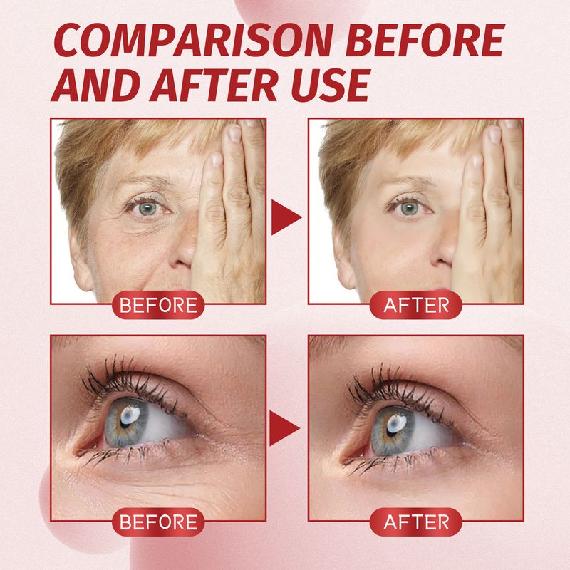 EELHOE Hydrating Anti-Wrinkle Essence, Fade Eye Lines, Lift Head Lines, Firming Skin, Moisturizing Anti-Aging Essence_voghion.com