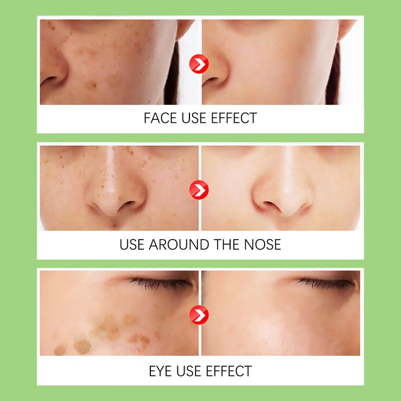 Jaysuing Spot Freckle Compaction Pigment Revitalizare Frumoasă a Pielii Decolorare Pete După Controlul Culorii Cremă Verde_voghion.com