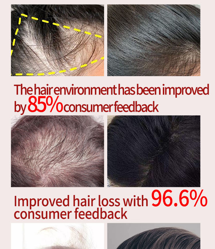 Biotin Fast 2023 Hoer Wuesstem Ueleg Hoer Wuesstem Serum Hoer Ausdünnung Behandlung Hoer Wuesstem Flëssegket Anti-Hoer Verloscht_voghion.com