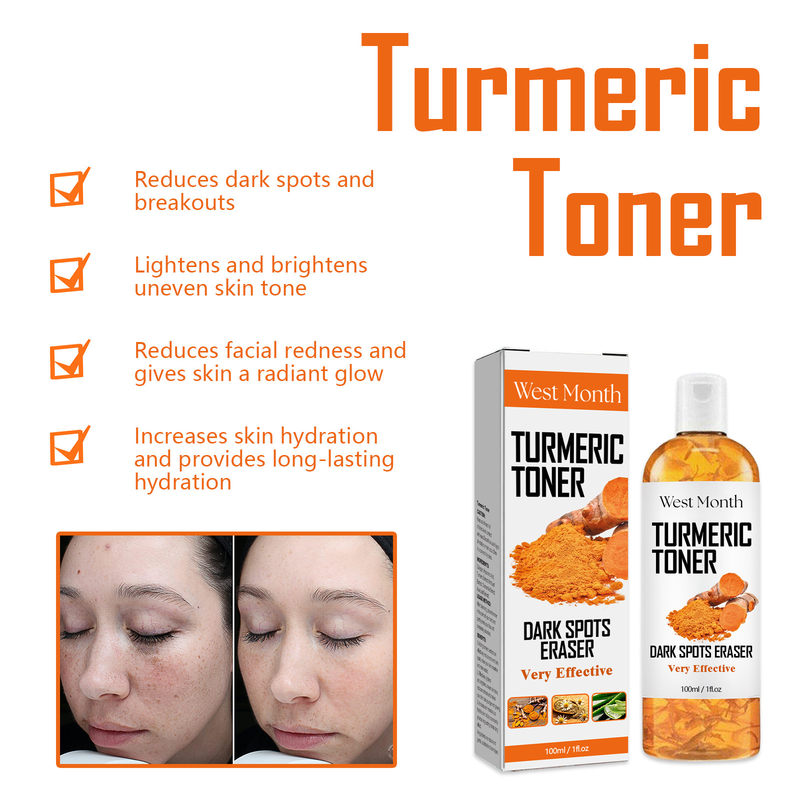 West&Month Black Turmeric Erfrischendes, tiefenwirksam hydratisierendes, straffendes, feuchtigkeitsspendendes und feuchtigkeitsspendendes Gesichtswasser_voghion.com