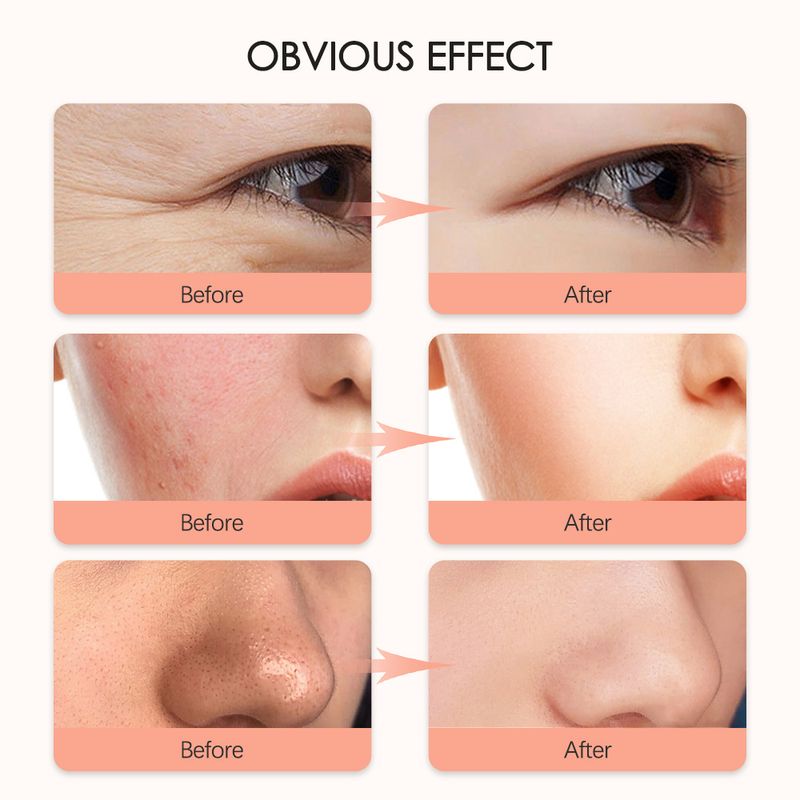 Neue siebenfarbige LED-Photonenmaske zur Erweichung und Aufhellung des Hauttons_voghion.com