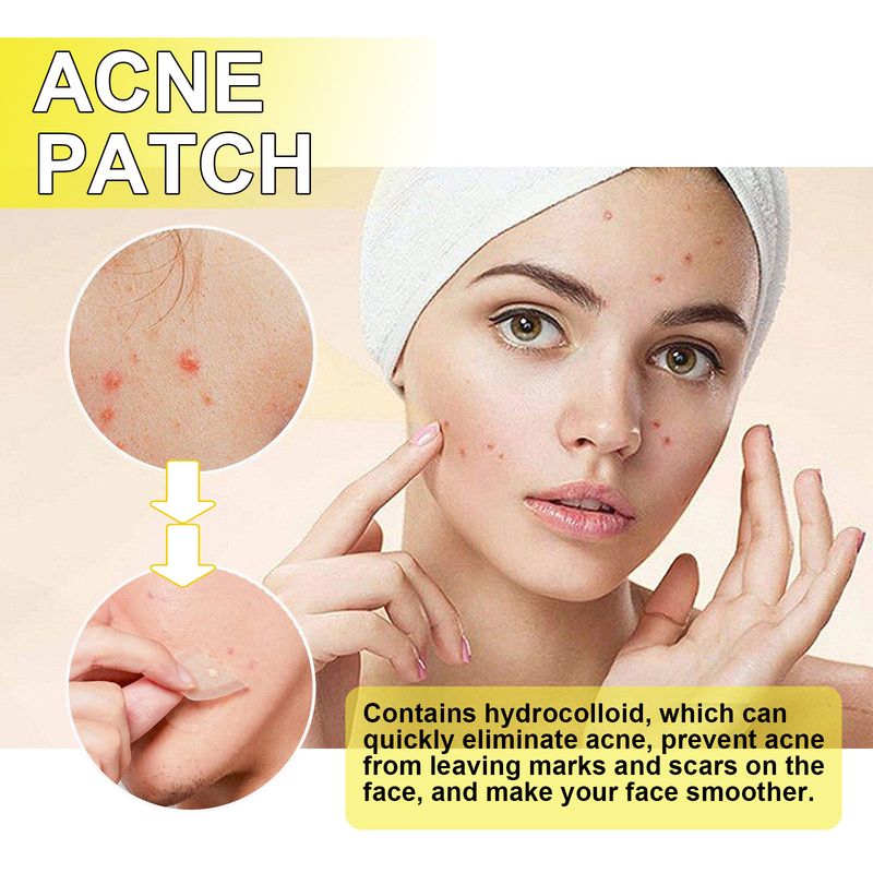 Jaysuing Acne Hydrocolloid Patch For Cleansing Facial Acne, Closing Mouth And Removing Blackheads Delicate Skin Patch_voghion.com