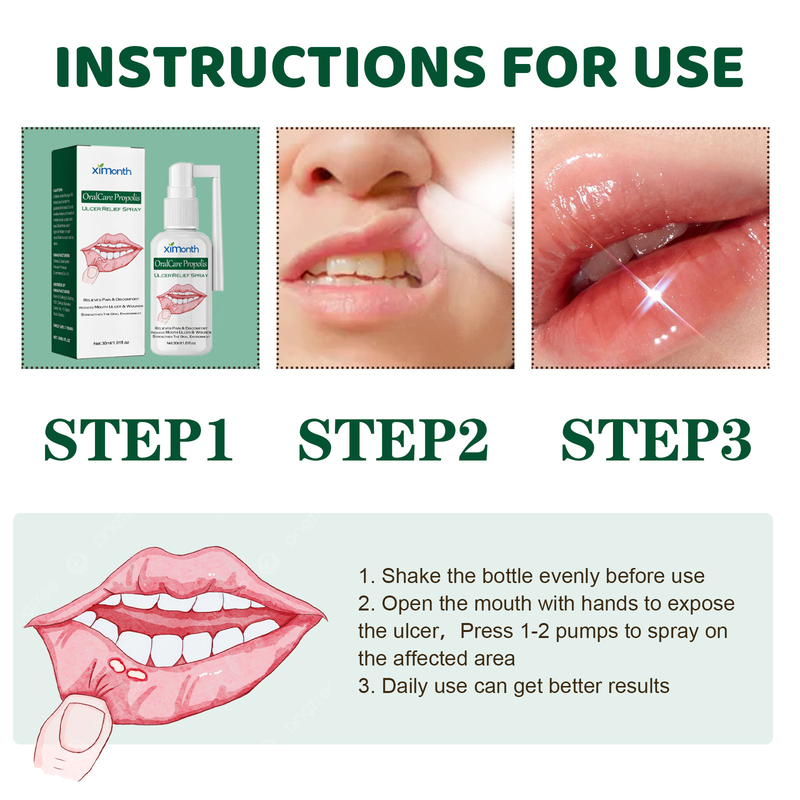 Oral ulcer XIMONTH relief spray_voghion.com