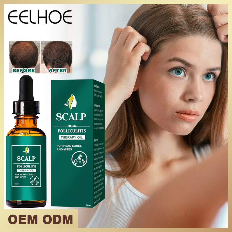 soins capillaires Huile essentielle du cuir chevelu pour un nettoyage en profondeur et la réparation des racines des cheveux, soulageant les démangeaisons, prévenant la perte de_voghion.com