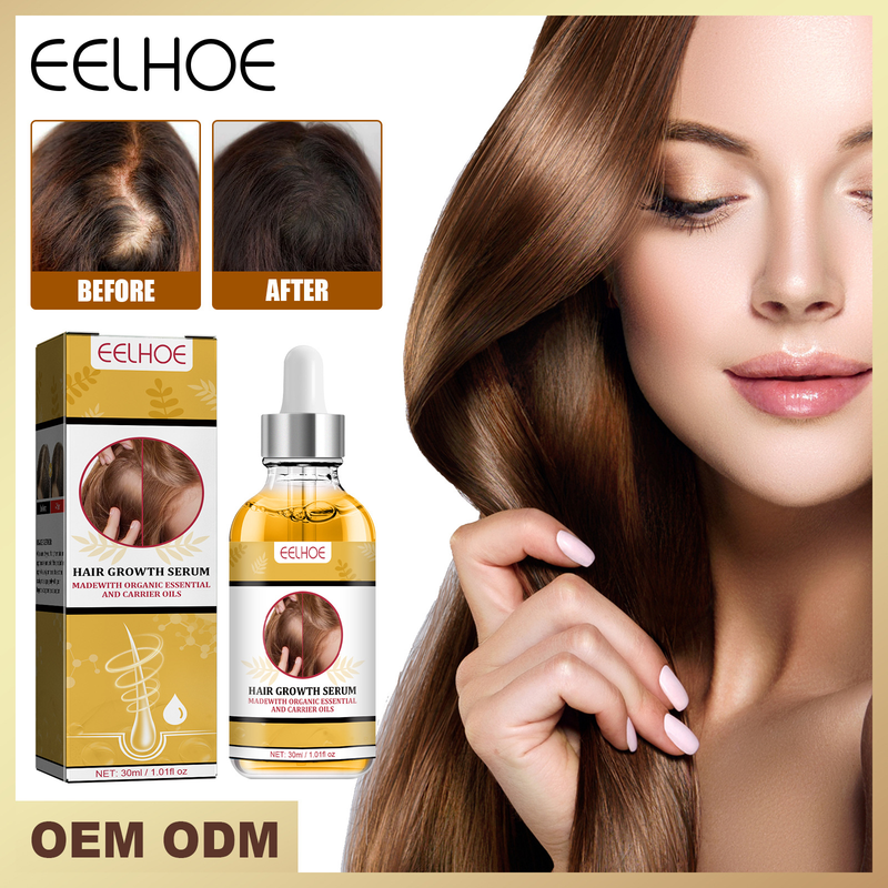 Das Fluid nährt die Wurzeln, verbessert die Widerstandsfähigkeit, beugt Haarausfall vor, festigt das Haar und fördert das Haarwachstum_voghion.com